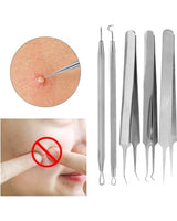 Blackhead Remover Kit